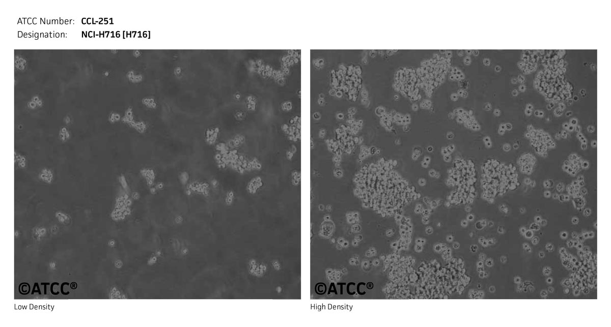 ATCC CCL-251 Cell Micrograph