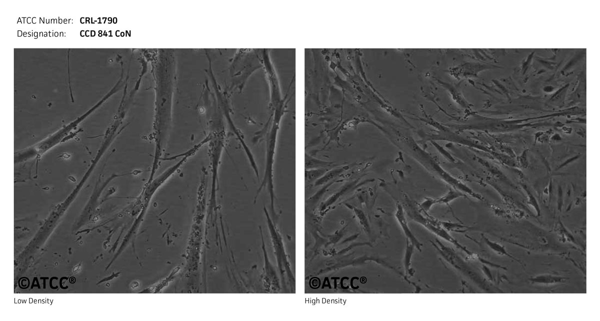 ATCC CRL-1790 Cell Micrograph