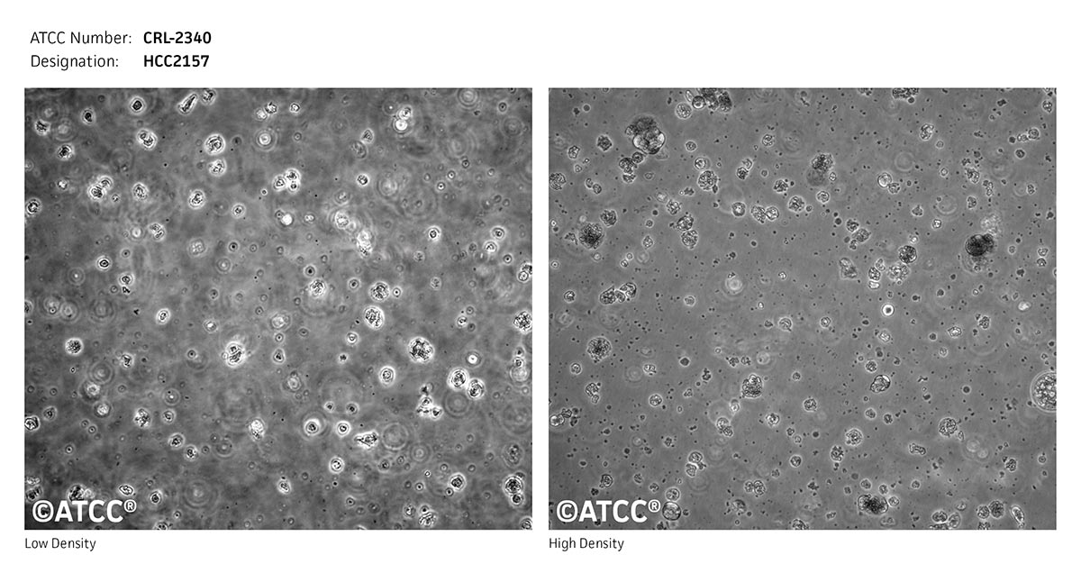 Cell Micrograph of ATCC CRL-2340, HCC2157