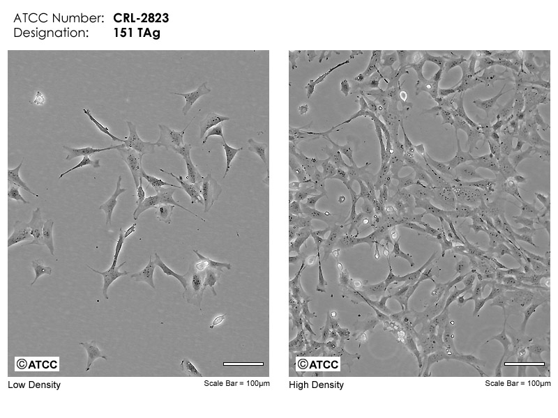 Cell Micrograph TAg ATCC CRL-2823 cells