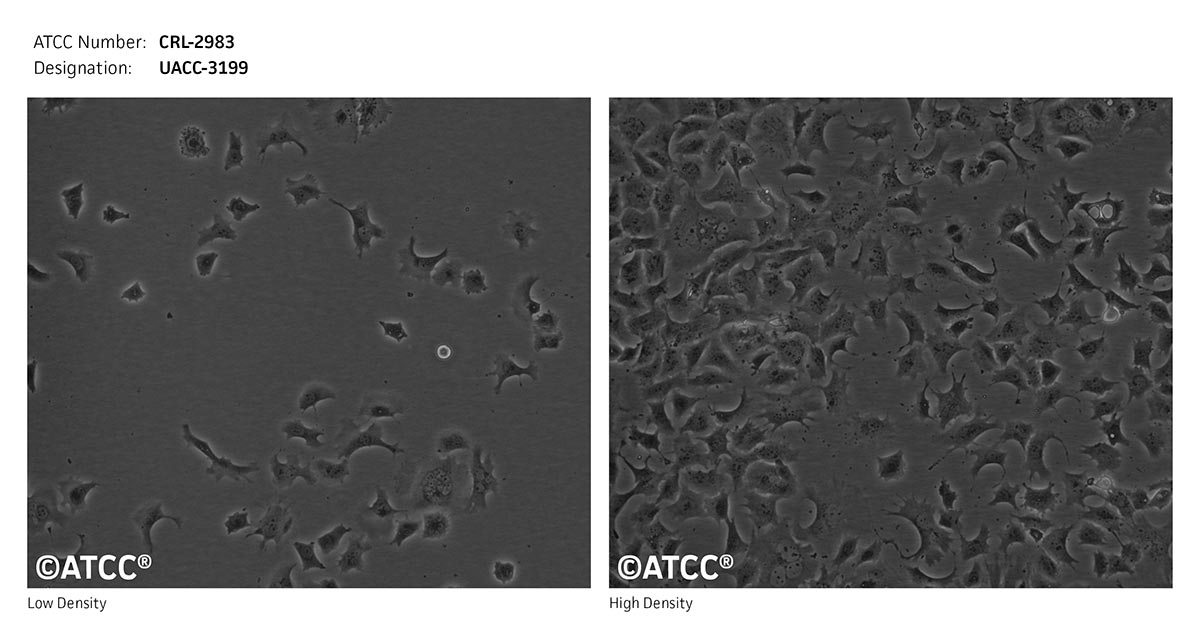 Cell Micrograph of UACC-3199 cells, ATCC CRL-2983