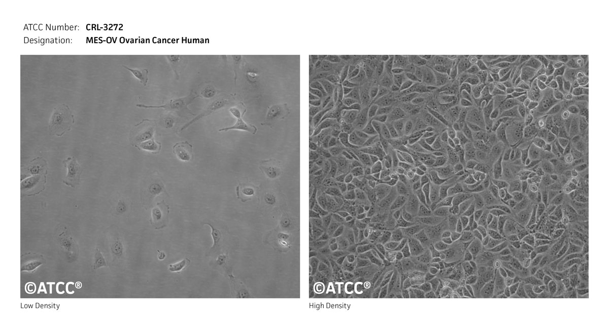 Cell Micrograph of MES-OV Cells, ATCC CRL-3272