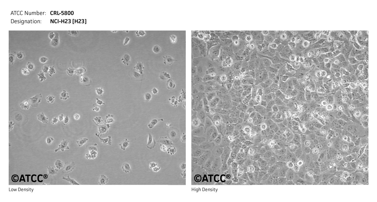 ATCC CRL-5800 Cell Micrograph