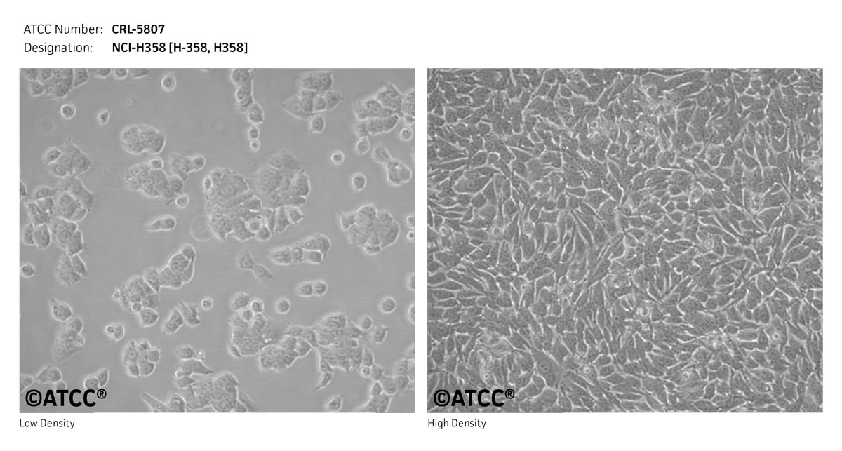 ATCC CRL-5807 Cell Micrograph