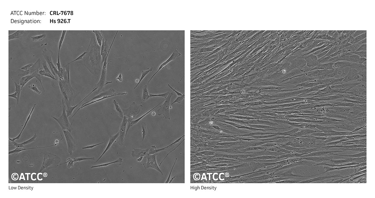 Cell Micrograph ATCC 7678 cell growth 
