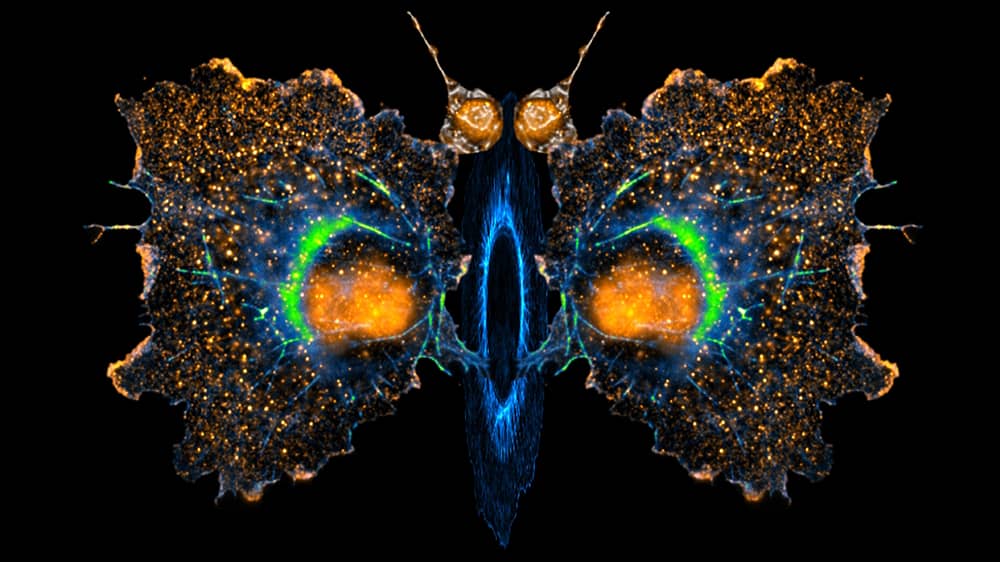 Fluorescent orange, blue, and green cells in the shape of a butterly.