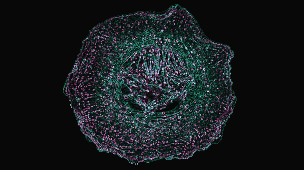Primary Human Umbilical Vein Endothelial Cell depicting the radiant distribution of actin cytoskeleton (green) and cell contact points (focal adhesions) represented via paxillin staining (magenta).