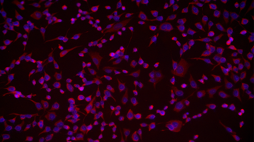 Oncogenic protein's cytoplasmic expression in A549 cells.