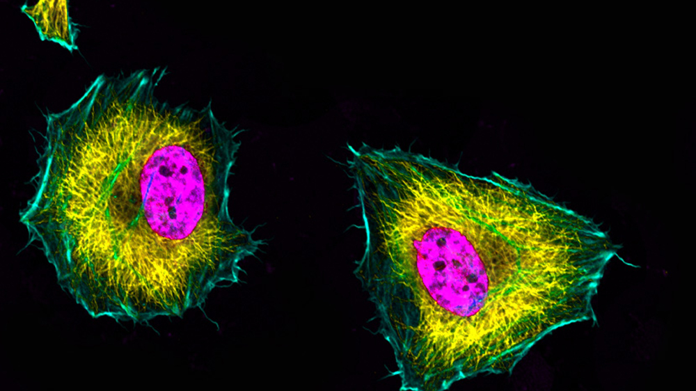 Hela cells stained for alpha tubulin in yellow, f-actin in teal and nuclei in pink.  