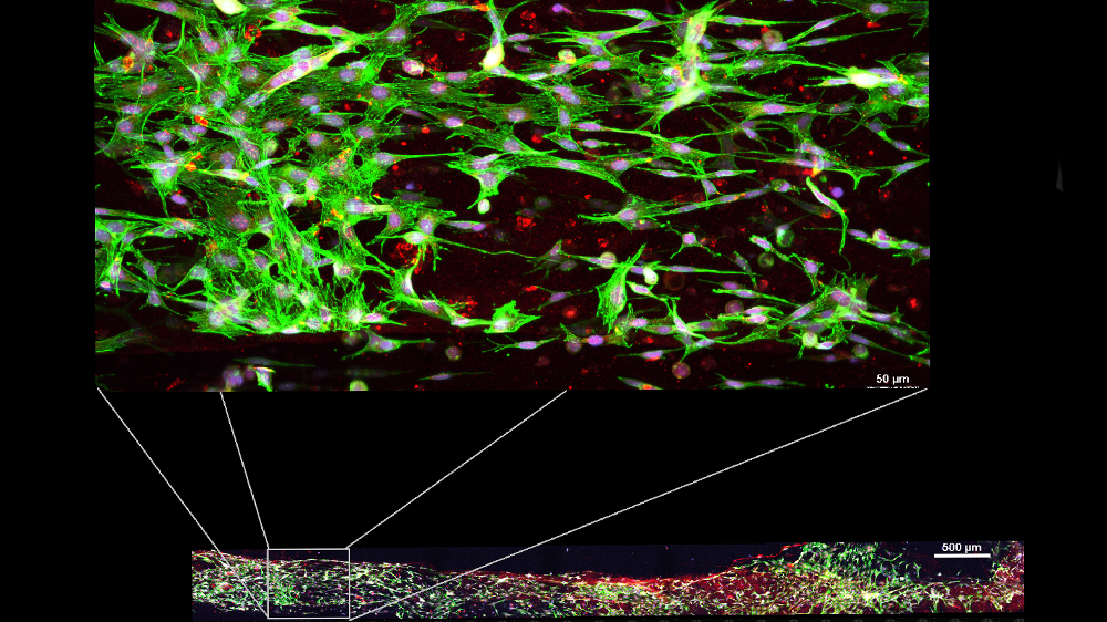 Human cells, skeletal myocytes, microchannels
