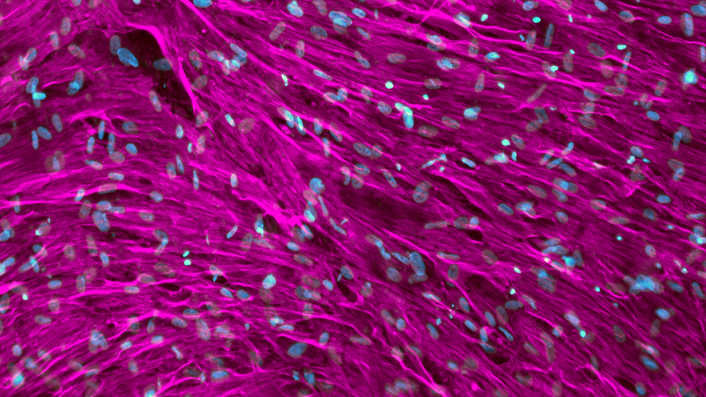 Osteogenic differentiated hBMSC cells stained with myosin IIA (purple) and nuclei (blue)