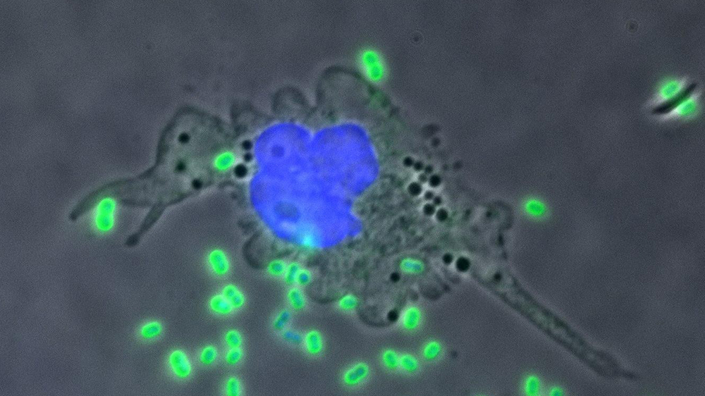 A THP-1 cell attacking antibiotic-resistant Acinetobacter baumannii