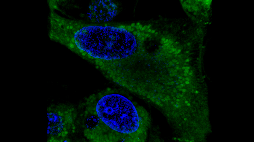 Curcumin BF2 accumulation in SKOV-3 cells