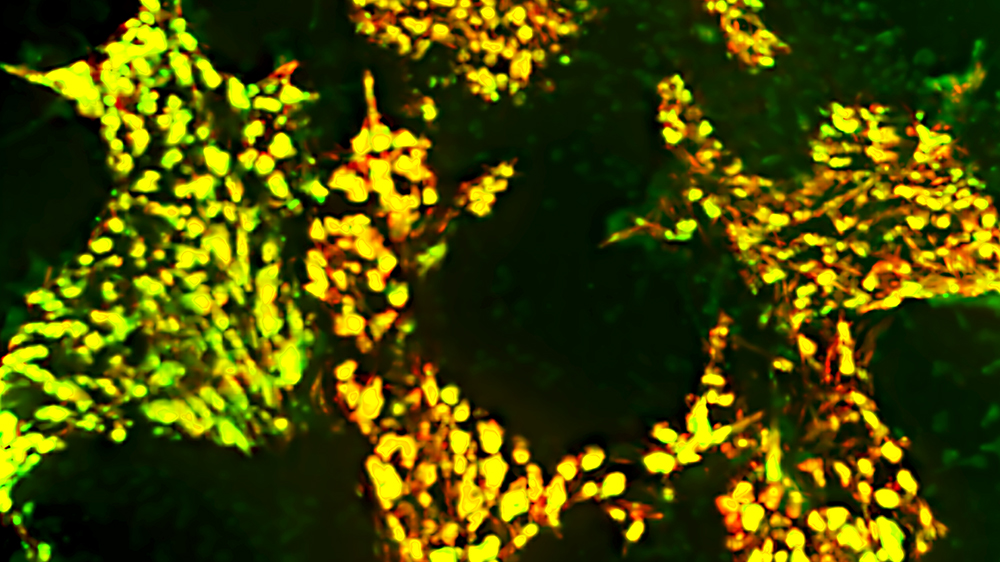 S-Acylation of Orai1 promotes CRAC channel formation and its targeting to lipid rafts. HEK293 Orai TKO cells were transfected with Orai1-GFP and STIM1-RFP and were imaged using TIRF microscopy. Time-lapse TIRF images were obtained after inducing ER store depletion using Thapsigargin. The single images are stacked to create a single image showing the movement of Orai1 and STIM1 to form puncta to promote store-operated calcium entry.