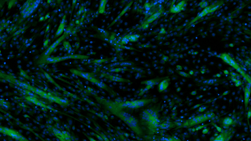 Differentiated mouse myoblast (C2C12) cells co-stained with a nucleus tracker Hoechst 33342 (blue) and a fluorescent glucose analog 2-NBDG (green).
