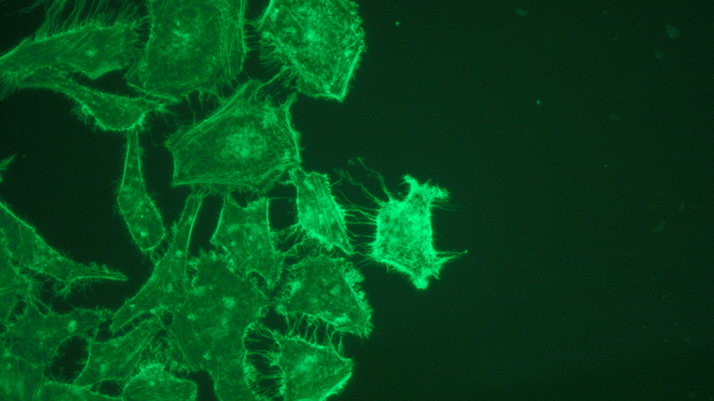 Cultured HeLa cells (ATCC CCL-2) straining for 5 minutes against vibration produced by an indoor air handler (8.3 ± 0.1 mm/s). Cell stained for actin with phalloidin-AlexaFluor488.