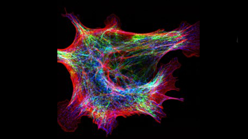This MEF cell (ATCC SCRC-1040) was fixed with 4% formaldehyde in PBS. Actin (red) is stained with phalloidin-TRITC. Microtubule (blue) and Vimentin (green) are stained with antibodies. Cells were imaged by structure illumination microscopy.