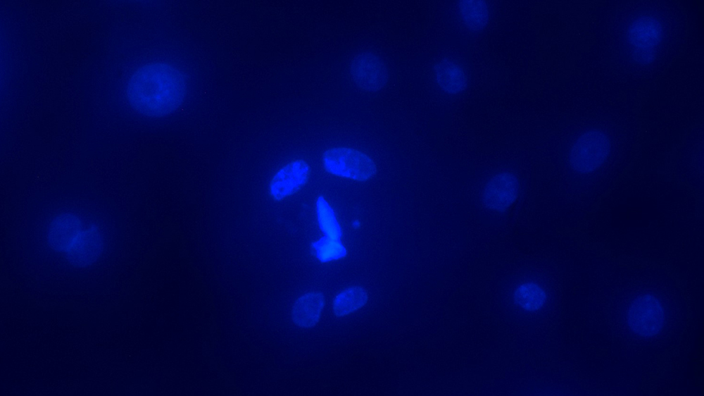 Primary Bronchial/Tracheal Epithelial Cells (ATCC PCS-300-010)