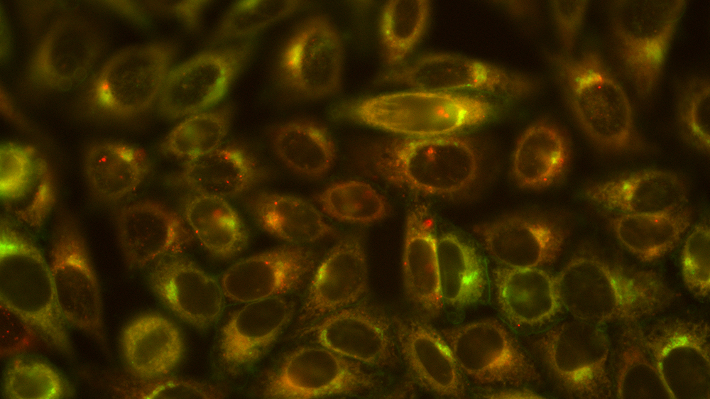 Human HEp2 cells (ATCC CCL-23) were co-stained with Golgi tracker (green) and a novel chlorin conjugate (red). The overlay of both shows an orange/yellow color.