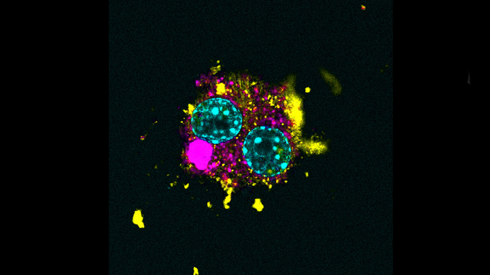 RAW264.7 cells (ATCC TIB-71) stained for nuclei, actin, and a-tubulin