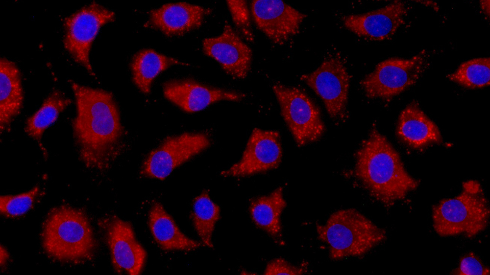 Fluorescent micrograph of liposome uptake by S42 cells (ATCC CRL-2942). This material is based upon work supported by the Army SBIR Program/US Army Medical Research and Development Command/U.S. Army Medical Research Acquisition Activity under Contract W81XWH-18-C-0004.