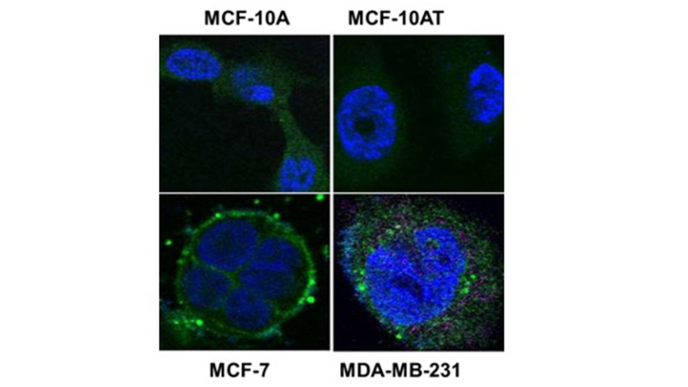 The expression of HERV-K was detected in both of breast cancer cell lines (ATCC HTB-22, ATCC HTB-26), but not in non-tumorigenic breast cells (MCF-10A or MCF-10AT) (ATCC CRL-10317) using anti-HERV-K antibody. 