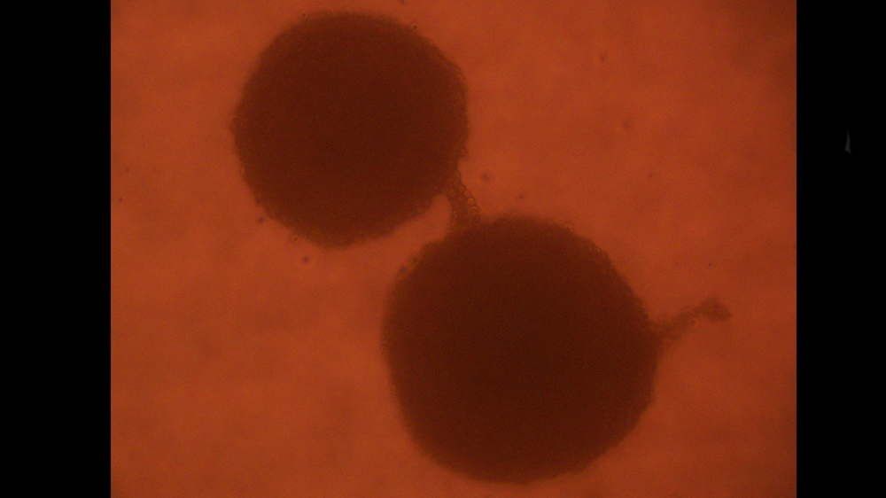 The human glioblastoma U87 MG cell line (ATCC HTB-14) was grown as a single cell culture in a hanging drop to allow 3-D growth. The resultant neurospheres appear to be communicating with each other via a tubular-like structure composed of cells.