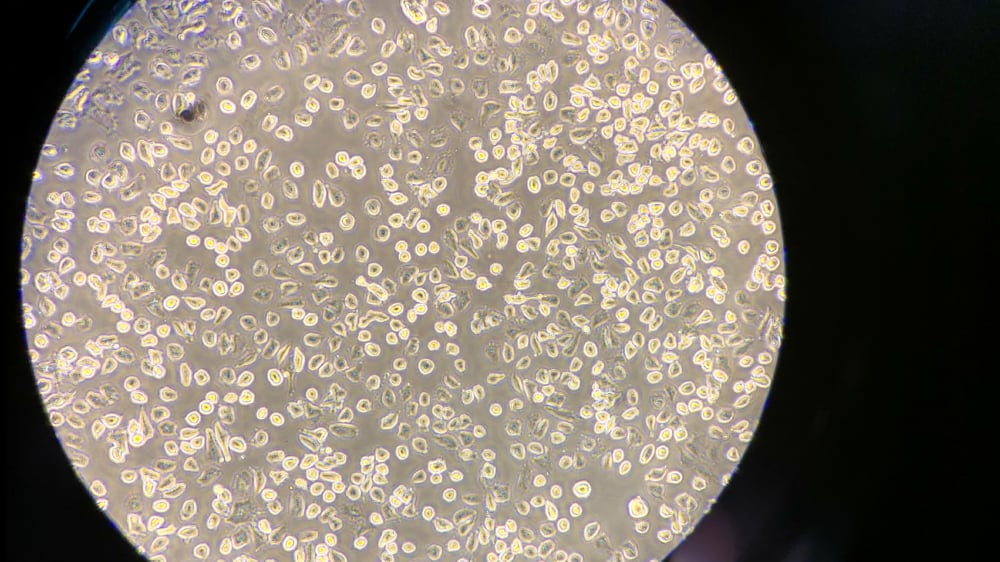 A549 cells (ATCC CCL-185) in culture following the trypsinization process, which explains why no adherence is seen.