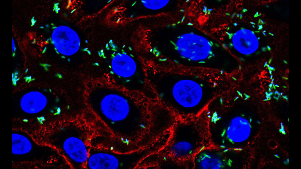 Sialidase treated VK2 cells (ATCC CRL-2616), stained with PNA lectin and infected with Fusobacterium nucleatum subsp. nucleatum (ATCC 23726). Blue = DAPI, Red=PNA lectin, Green = F. nucleatum.