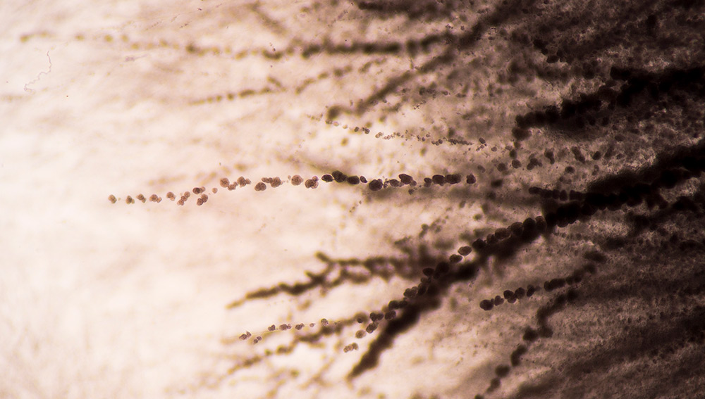 Brown, grainy, leaf-like fronds of Candida albicans fungus.