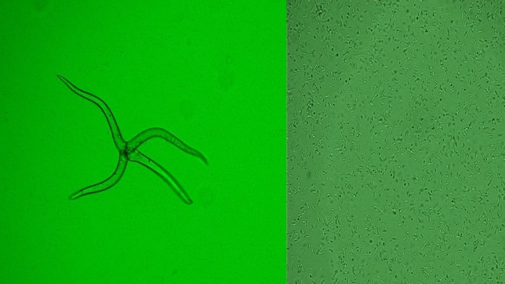 Escherichia coli GFP was cultured with ATCC Medium 2855 and used as the bacterial inoculum to simulate the biofilm formation, then the coverslips were visualized with an epifluorescence microscope for bacterial attachment with or without Nanobubbles treatment.