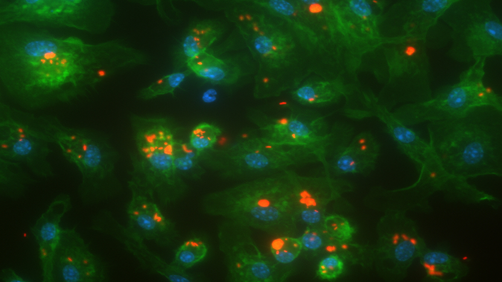 Bone marrow derived macrophages marked with phallodin (pink) and Hoechst (yellow) engulfing E. coli K12 (blue).