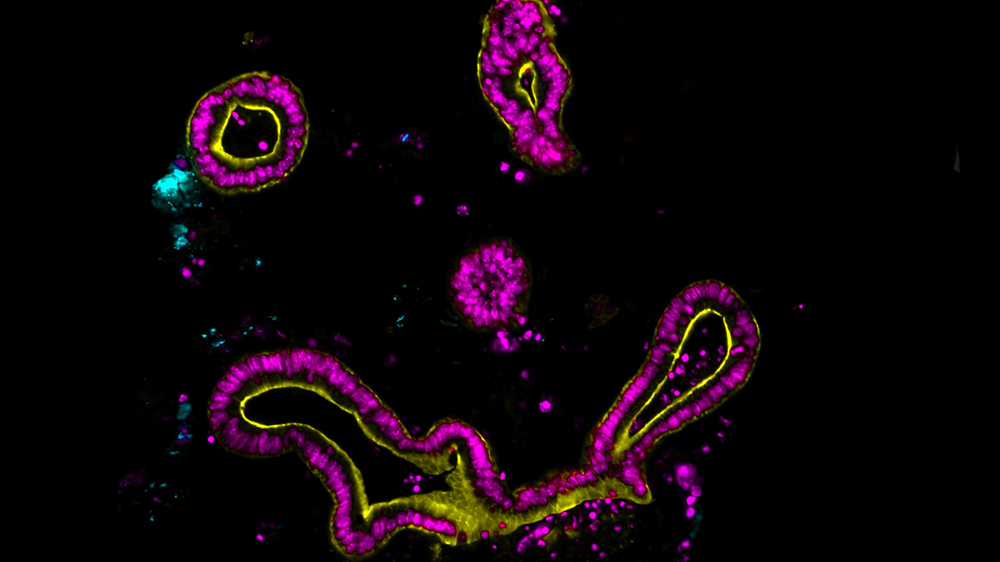 Mouse jejunal organoids incubated with fluorescently tagged ATCC 23055