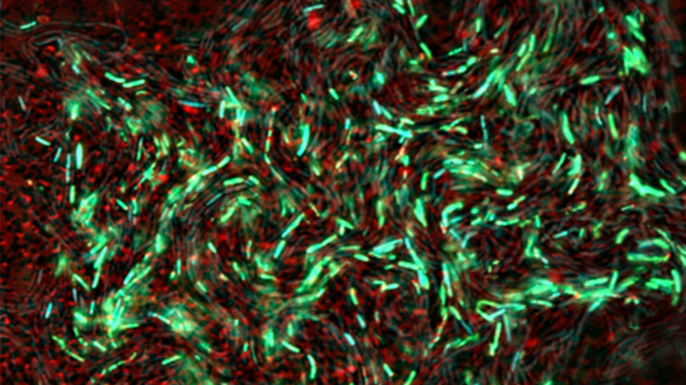 Bacterial cytological profiling for the discovery of new drugs to combat multidrug-resistant bacteria. Fluorescence image of Bacillus subtilis stained with SynaptoRed, SYTOX Green and DAPI after treatment with ciprofloxacin.  "