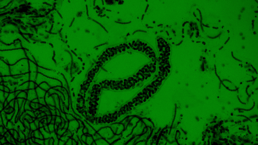 Phase contrast image of Nostoc sp. (ATCC 27893) at an excitation of 495 nm. Careful inspection shows the presence of heterocysts which allow for the fixation of nitrogen.