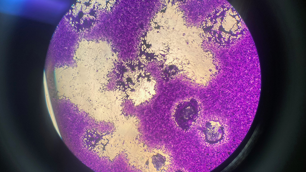 Plaque assay showing EHV-1 infecting rabbit kidney epithelial cells (RK-13)