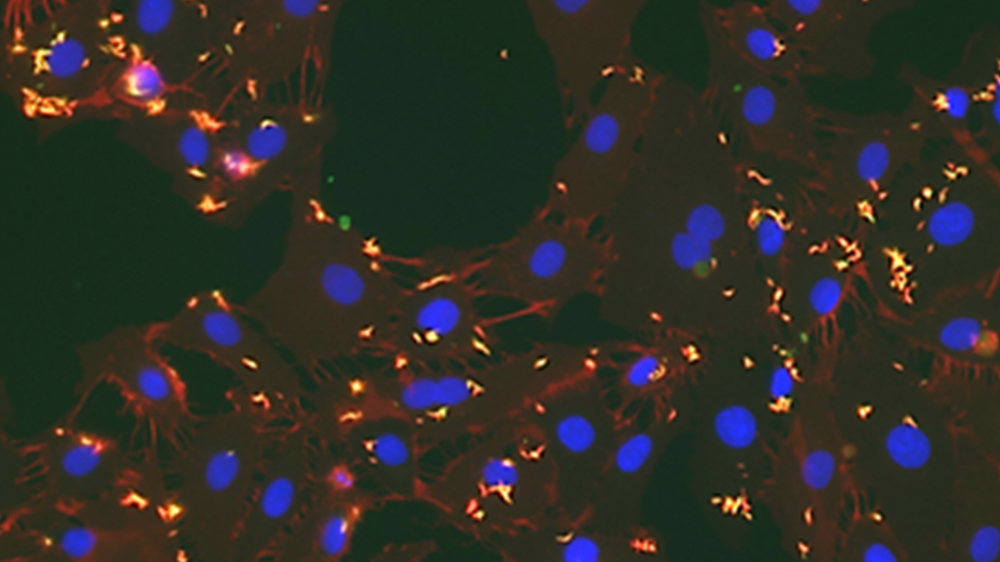 Mycobacterium tuberculosis H37Rv (ATCC 25618) infects mouse lymphatic endothelial cells (LECs). Using flour microscopy, we observed that GFP-Mtb were internalized.