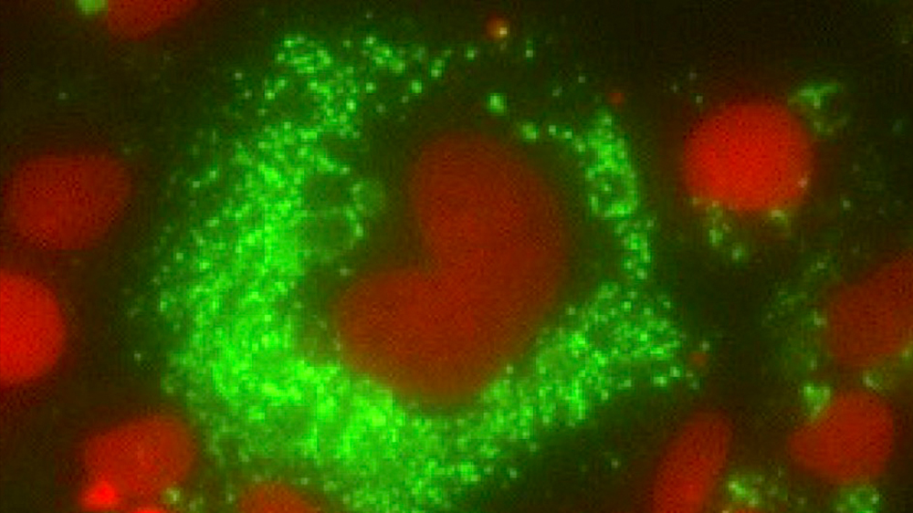 Zika virus (ATCC VR-1843) infection of Mocha cell (rat cochlear microglial cells line). Fixed and stained with human anti-Zika and goat anti-Human Ig Alexa 488. Nuclei are stained with DAPI.