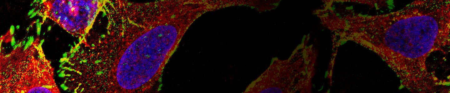 Red, purple, green, and yellow A549 CRISPR cells.
