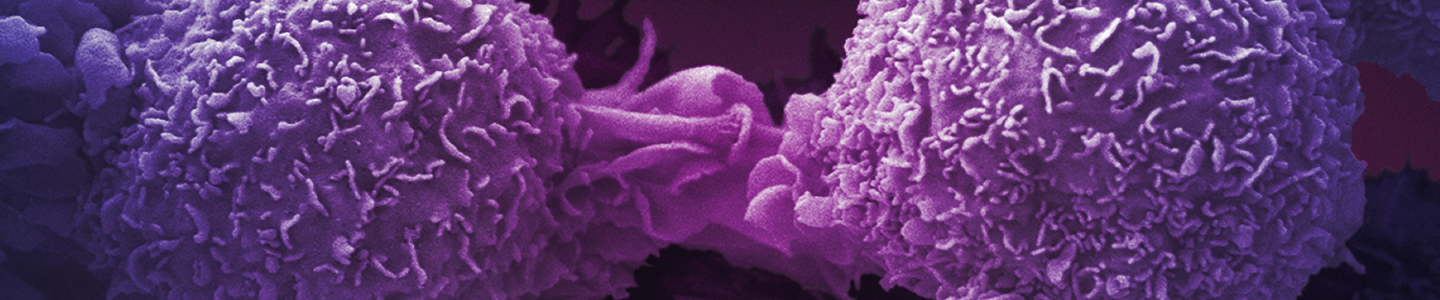 Round, textured, purple lung cancer cells on a dark background.
