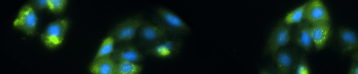 Clusters of blue and green exosomes.