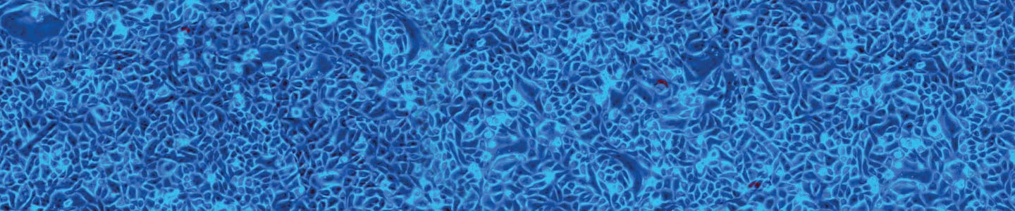 Blue prostate cells.