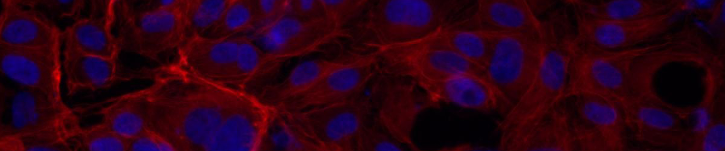 Red and blue phalloidin human umbilical vein endothelial cells.