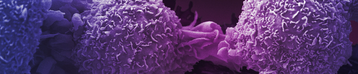 Purple lung cancer cells.