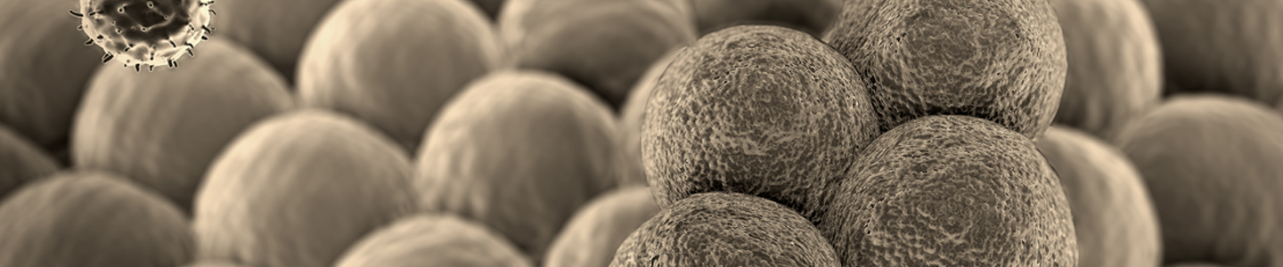 T-lymphocyte cancer cells.