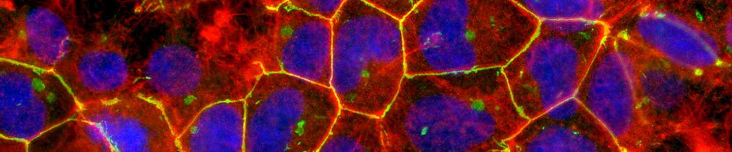 Red and blue hek 293 stained protein.