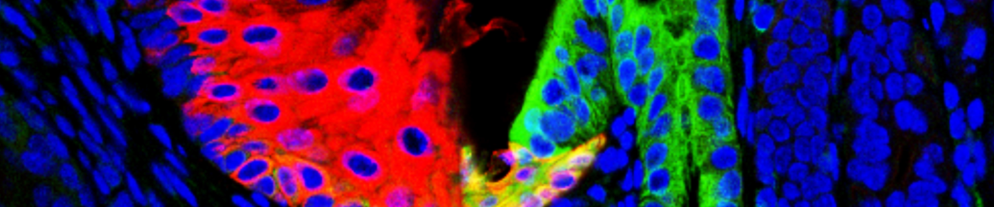 Blue green and red barretts esophagus cells.