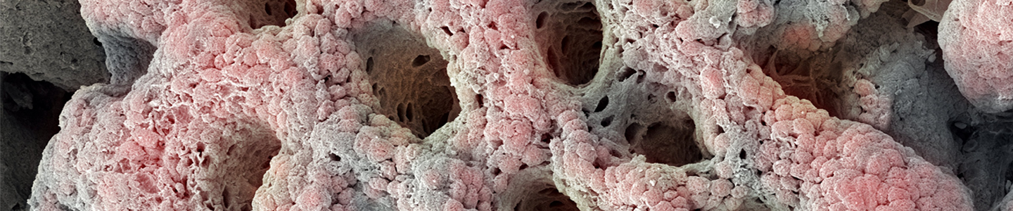Pink and gray stomach gastric pit cells.