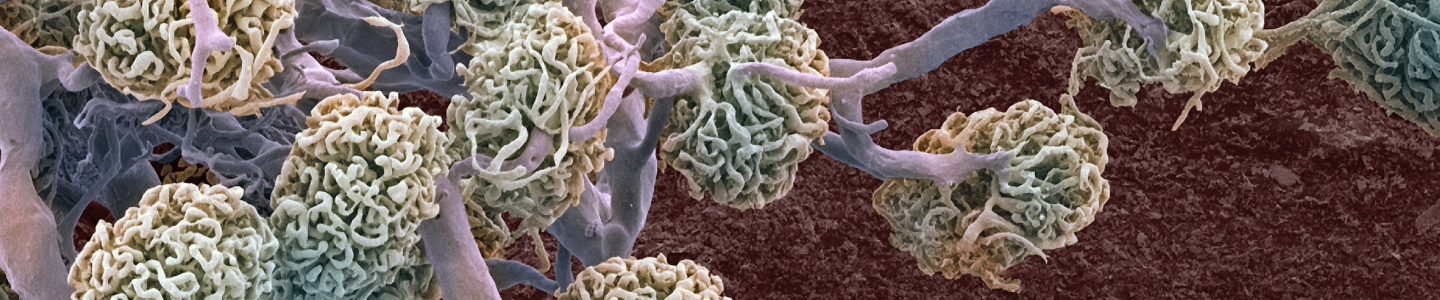 White, green and blue kidney glomeruli.