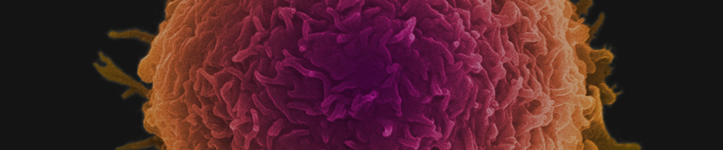 Human oral squamous carcinoma cell.